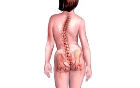 Le ragioni dello sviluppo dell'osteocondosi cervicale