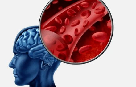 Sintomi di osteocondosi della colonna cervicale