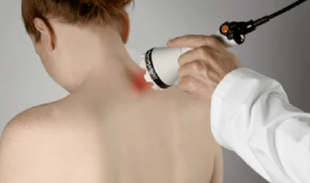 Trattamento dell'osteocondrosi cervicale mediante fisioterapia