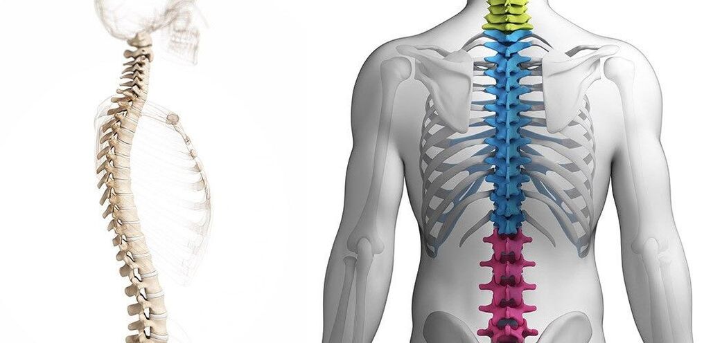 lesione della colonna vertebrale toracica con osteocondrosi