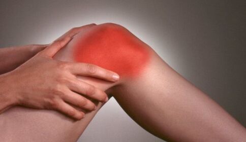 dolore al ginocchio dovuto all'artrite