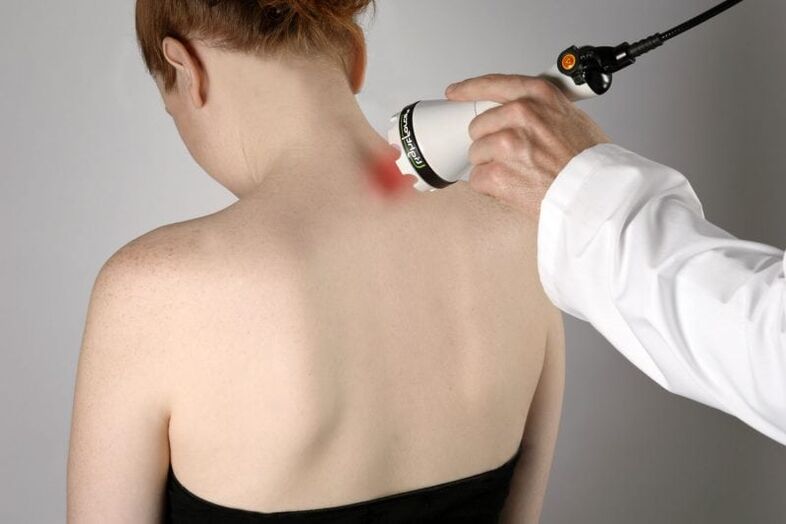 Trattamento dell'osteocondrosi cervicale in una donna con un laser