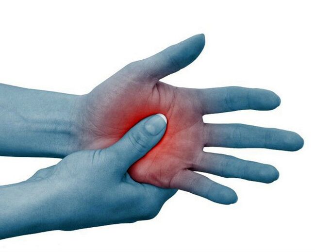Un forte dolore alle articolazioni delle dita, che diminuisce con l'esercizio, è un tipico segno di artrite reumatoide. 