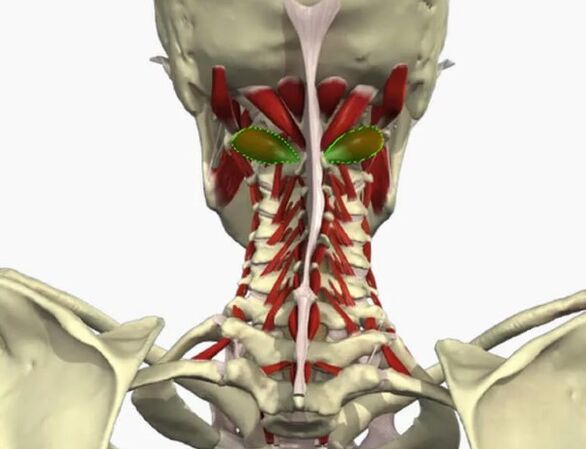 Sindrome dell'arteria Vail